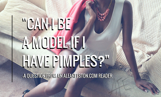 Reader Question: I have Pimples. Can I Still be a Model?